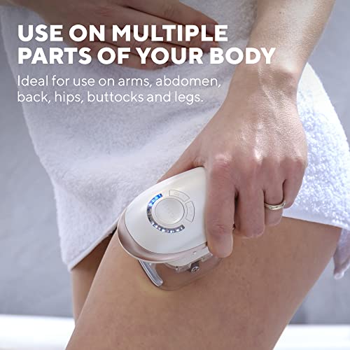 HoMedics-Smoothee-Masajeador-Anticelulitico-a-Succion-con-Ventosas-de-Vacio-Intercambiable-Tratamiento-Suavizante-Contra-la-CelulitisDesintoxica-la-Piel-Recargable