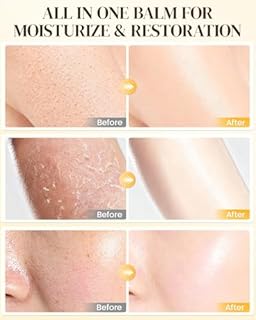 GAJUANR Bee Venom Moisturizing Cream, All-in-One Nourishing Moisturizer with Hyaluronic Acid, Firming & Hydrating Face and Body Cream, Natural Gentle Formula for All Skin Types (60g * 2PCS)