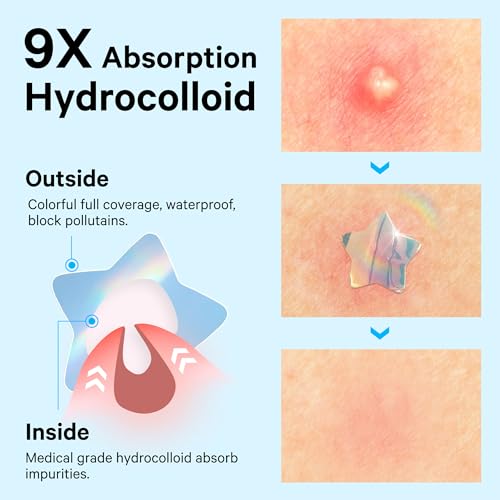 Image of Sosky Hologram Pimple Patches for Face, Hydrocolloid Acne Patches with Salicylic Acid, Cute Star Zit Stickers,Colorful Blemish Covers,48 Count Blue Cloud
