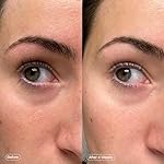 Topicals Faded Brightening Under Eye Masks | Revitalizing Patches to Depuff, Hydrate, and Illuminate | Diminishes Dark Circles and Fine Lines | Made with Kojic Acid, Caffeine & Niacinamide - Image 5