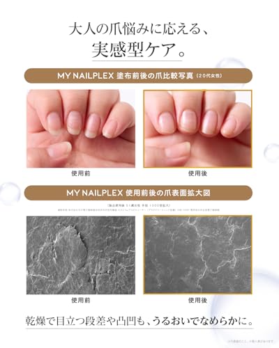 TITANAIL マイネイルプレックス ネイルオイル 10mL