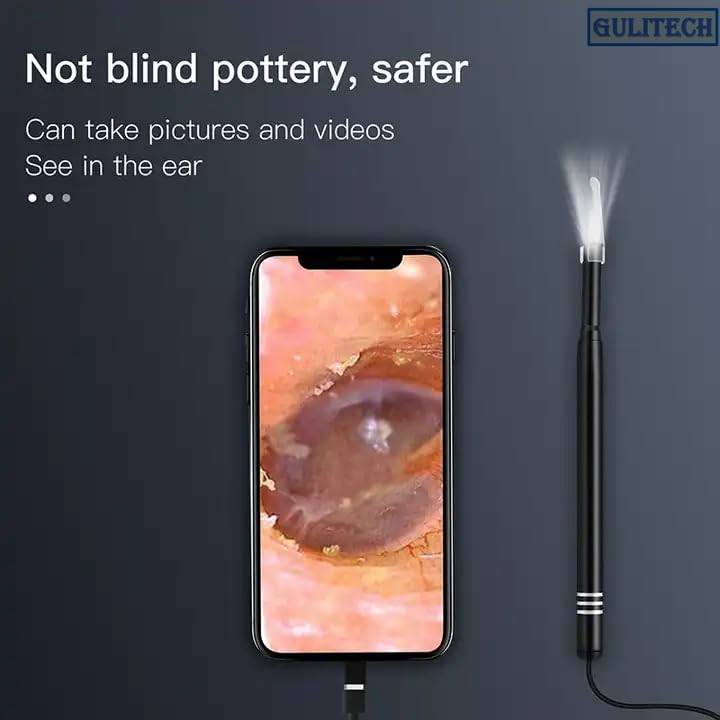 Visual Ear Cleaner Camera 3in1 Type-C USB Visual Otoscope 3.9mm 0.3MP 6LED Lights Earpick Ear Spoon Endoscope for Android(3.9mm-Black)