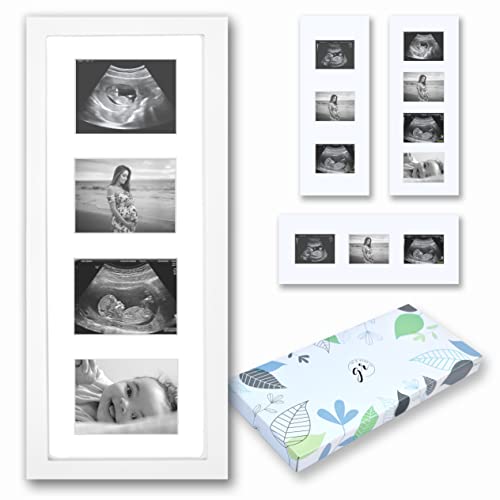 Image of Grehge Baby Ultrasound Picture Frame | Electronics Wireless Earbuds, Bluetooth Headphones Wireless Headphones