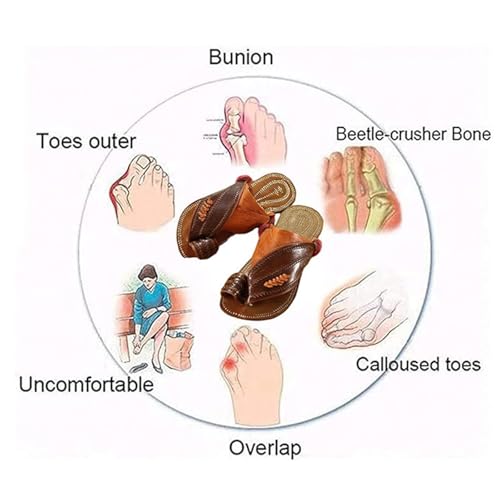 Yytcsjz Men Outdoor Flat Slippers, Casual Men's Non- Slip Slip-On Breathable Orthopedic Bunion Relief Sandals, Open Toe Plantar Fasciitis Flip Flops, for Hallux Valgus, Plantar Fasciitis3