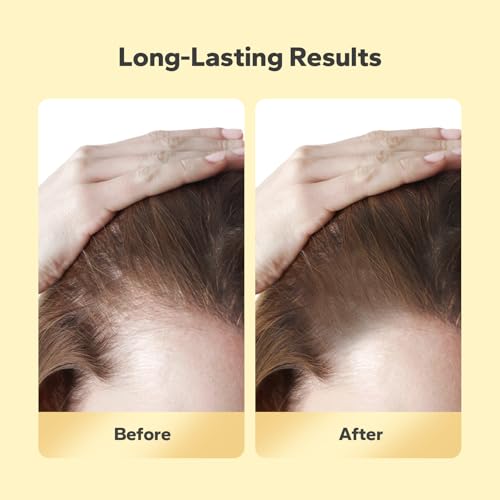 Styleshark Hairline Powder - Stain-Proof Root Touch-Up For Thinning Hair thumb #5