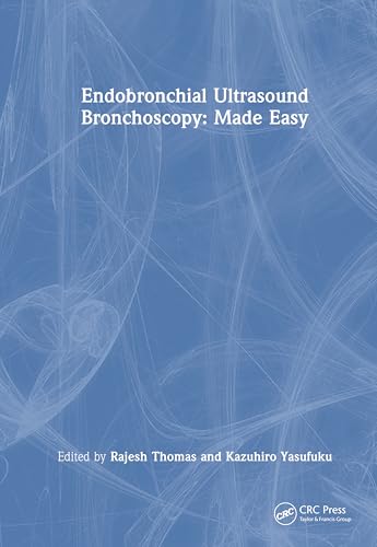 Endobronchial Ultrasound Made Easy: Made Easy