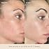 Barefaced Core Four - Original Toning Pads, Liquid Gold, RetinAL, Tinted SPF - the Foundation for Healthy Skin