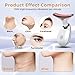 Facial Beauty Device, Based on Triple Action LED, Thermal, and Vibration Technologies for Skin Care, Facial Skin Care Tools, 7 Color Led Face and Neck Beauty Device for Home Use
