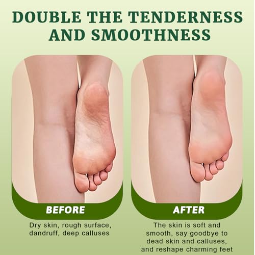 2 Paar Fußmaske, Fussmaske Feuchtigkeitsspendende, Anti Hornhaut Socken, zur Repariert Raue Fersen, Fußpflege Geschenke,Aloen