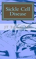 Sickle Cell Disease: Fast Focus Study Guide 1511984856 Book Cover