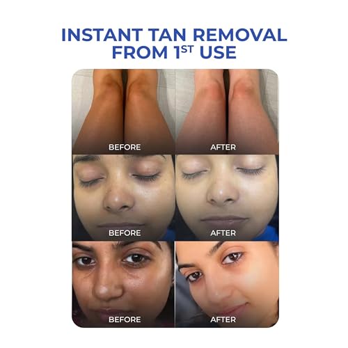 Image of Aqueria Instant De-Tan & Brightening Exfoliating Body Wash with Kojic Acid, Niacinamide, Glycolic Acid, Ceramide Complex & Vegan PDRN | Tan Removal Shower Gel for Dark Spots, Pigmentation & Uneven Skin Tone | Gentle Exfoliating Detan Body Cleanser | Works on Strawberrry Skin & Bump, Removes Acne & Acne Marks | Suitable for All Skin Types | 400ml