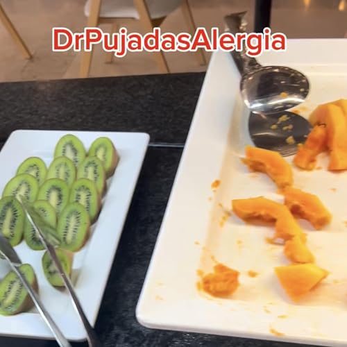 &iquest;Es seguro comer fuera con alergia? Errores graves en buffets y restaurantes