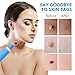 Skin Tag Remover Device FDA-Cleared Safe and Effective Skin Tag Removal Kits Home Use
