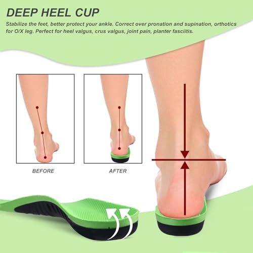 Image of Bacophy Kids Orthotic Arch Support Insoles, Plantar Fasciitis Cushioning Shoe Inserts, Shock Absorption Velvet Surfaces Deep Heel Cup Chinldren Inner Soles for Flat Feet, Feet Heel Pain Relief