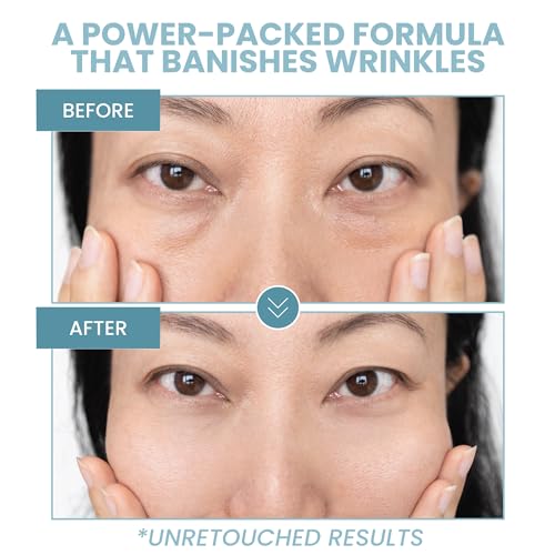 Eva Naturals ENEG2 Anti-Aging Eye Gel - Luxurious Hydrating Under Eye Cream For Dark Circles And Puffiness, Bags, Crows Feet, Wrinkles - With Hyaluronic Acid & Skin-Firming Peptides Eye Serum thumb #4