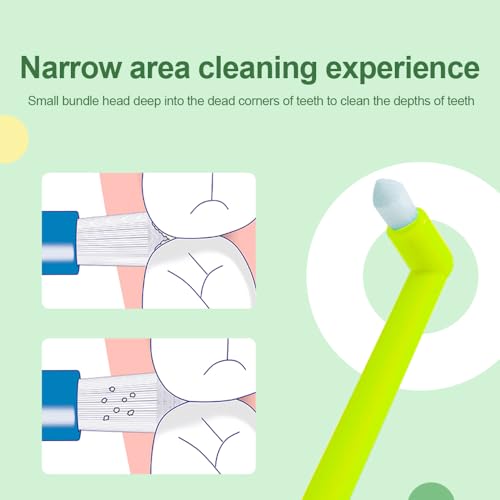 Image of Boxed Portable Orthodontic Care Kit Orthodontic Toothbrush Kit for Braces for Orthodontic Patient Travel Oral Care Kit Dental Travel Kit Interdental Brush Dental Wax Dental Floss (8 Pcs /Pack)-Blue