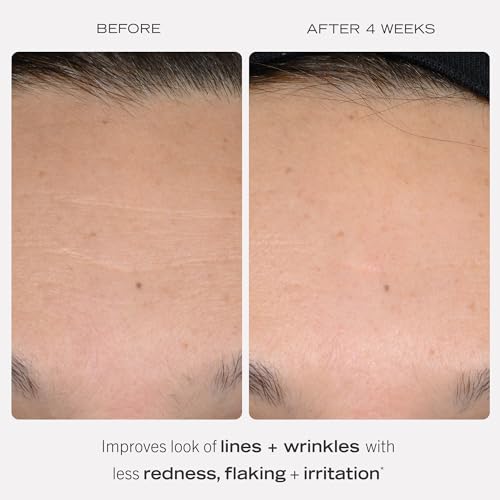 First Aid Beauty, 0.3% Retinol Complex Serum with Peptides - Image 2