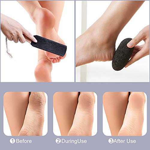 PETSUPS Natural Pumice Stones for Feet, Premium Exfoliator & Foot File,Foot File Callus Remover Foot Cracked Heels,Dead Skin,Hard Skin - Image 4