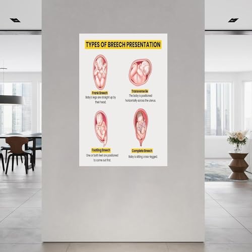 Guide position fœtale affiche éducation prénatale poster présentation siège anatomie - 3