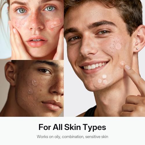 ZATKTK Pimple Patches for Face, 920 Count Hydrocolloid Acne Patches with Salicylic Acid, Bulk Pimple Stickers for Zit Breakouts and Blemishes, 4 Sizes, Fast Absorbing Spot Patch