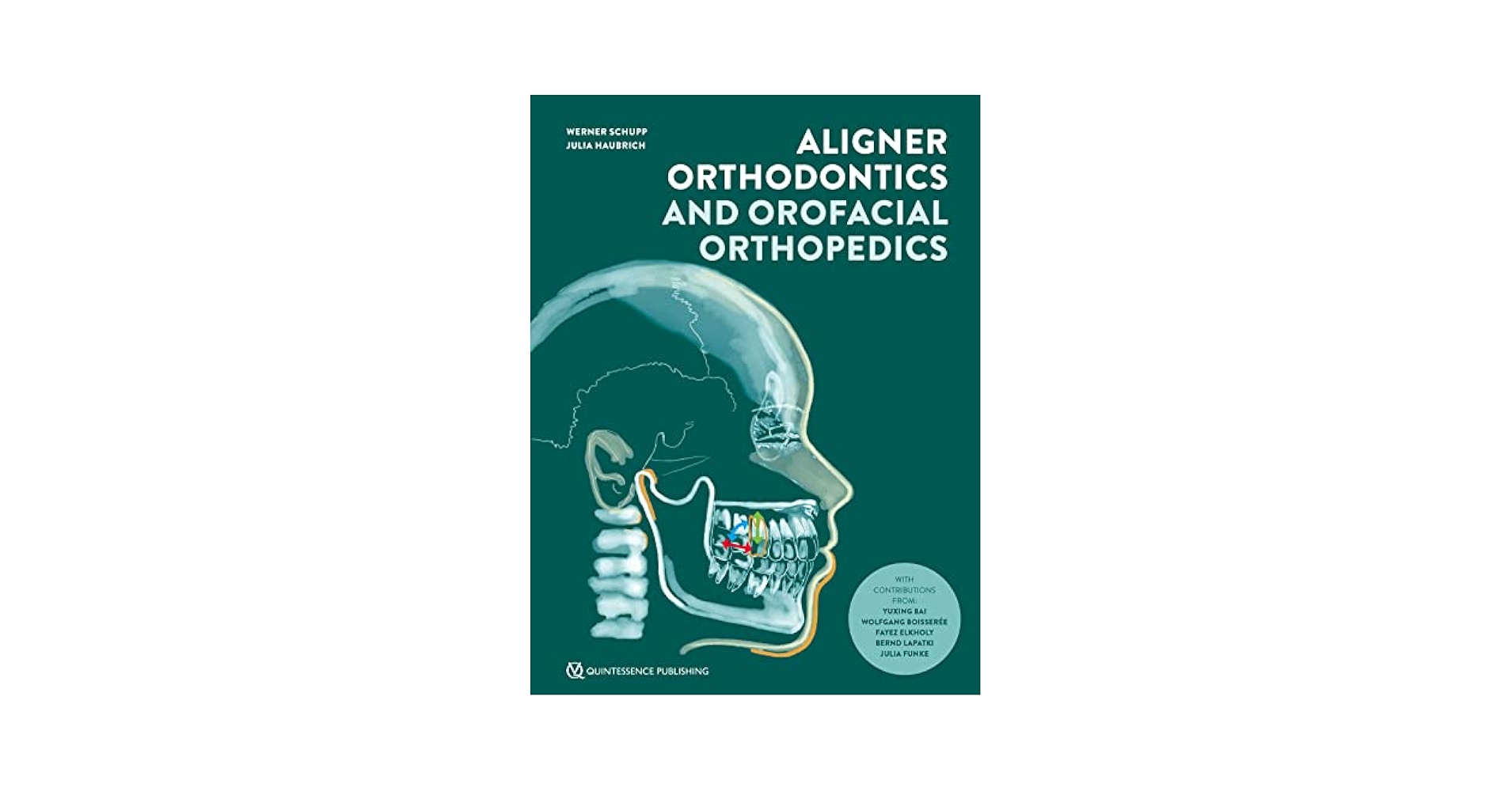 健康・医学 267 Aligner Orthodontics and Orofacial Aligner Orthodontics and Orofacial Orthopedics - Kindle