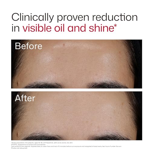 Image of EltaMD UV Clear Face Sunscreen with Zinc Oxide, Oil-Free, SPF 46 and SPF 50 | Calms and Protects Acne-Prone Skin and Rosacea, No White Cast, Dermatologist Recommended, Available in Three Tints and Sizes