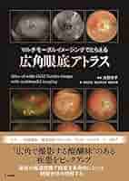 角膜アトラス 製品一覧：眼科