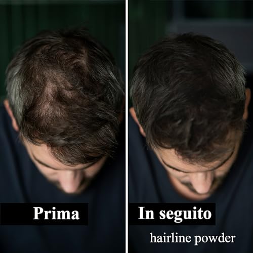 Leon Miguel® Hair Line Powder – Correttore/Approccio Puder | Per Capelli E Capelli Su Crescita Attraverso Shadow Make Up | Resistente All' Acqua (Marrone Scuro) - 5