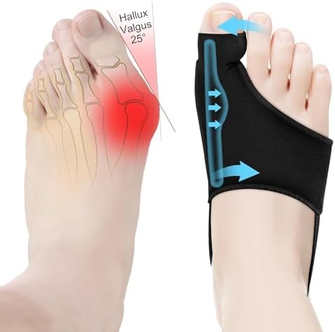 2PCS Bunion Corrector for Women & Men Big Toe Straightener-Bunions Correction Women & Men-Bunion Splint-Bunions Pads for Bunion Relief-Hallux Valgus Pain Relief,Comfortable & Breathable for Day/Night