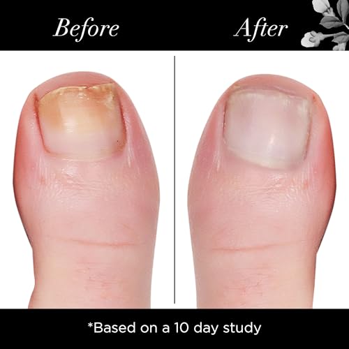 butter LONDON Illuminating Nail Concealer – Strengthener, Treatment and Sheer Polish, Brightens Yellowing, Damaged or Discolored Nails; 10-Free