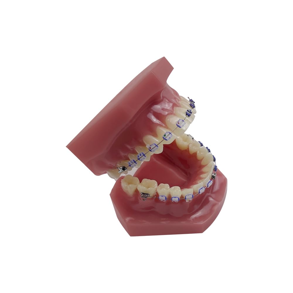 Orthodontisches Zahnmodell mit Halterungen, YOUYA DENTAL Demonstration Orthodontisches Modell für Bildung, Zähne Demonstration Typodonte Anatomisches Lehrwerkzeug mit Metall und Keramischer Halterung