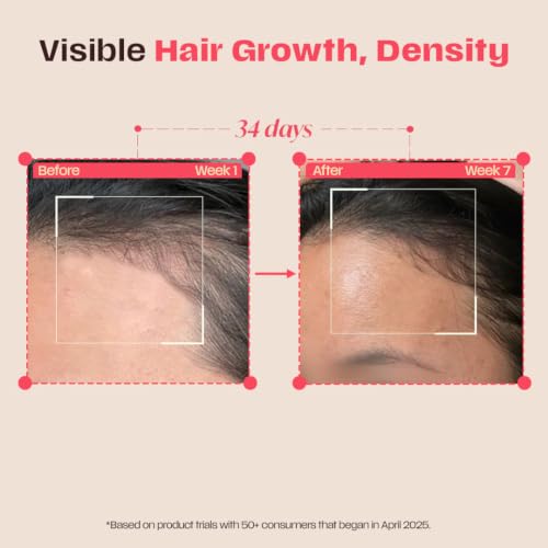 Image of Days Ahead Leave-in Hair Growth Ampoule Serum (Roll on) | 16% Growth Actives | PDRN, Redensyl, Anagain | Hair Growth Serum | Promotes Growth, Increases Density | Non-Greasy | For Women & Men | 25 ml