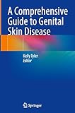 A Comprehensive Guide to Genital Skin Disease