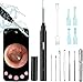 Price comparison product image Ear Wax Removal Camera, Ear Wax Remover Kit, Ear Cleaner Tool, 1080P FHD Wireless Ear Scope Endoscope with 6 LED Lights, Ear Cleaning Otoscope for Baby Kid Adult iPhone iPad Android (Black)