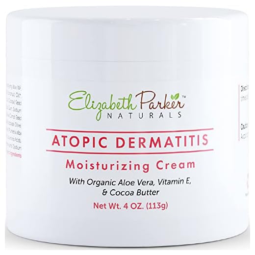 Elizabeth Parker Naturals Atopic Dermatitis Skin Cream with Organic Formula - Anti Itch Cream and Moisturizer for Seborrheic Dermatitis, Eczema and Psoriasis - Itch Relief and Repairs Dry Skin (4 oz)