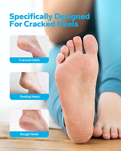 Moistmate 2-Pairs Heel Socks For Dry Cracked Feet, Moisturizing Socks For Foot Care, Cracked Heel Repair For Dry Feet, Foot Calluses, Rough Heel, Aloe Socks For Women And Men, Foot Spa Socks (Grey) #TOP1