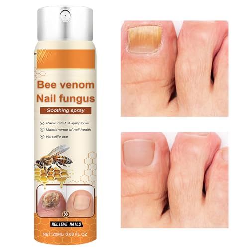 Solución para el Cuidado de Uñas,Spray Fortalecedor con Nutrientes Renovadores | Tratamiento Diario para Uñas Dañadas de Manos y Pies con Reparación y Mantenimiento