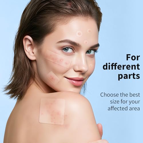 Image of Daolyo Large Pimple Patches for Face, 7 Sizes 210 Counts XL Acne Patches, Big Hydrocolloid Bandages for Body, Chin, Forehead, Chest, Back Zit Breakouts (Strip, Square, Round)