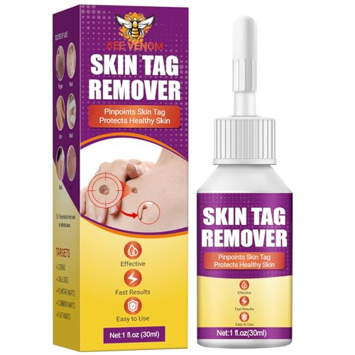 Skin tag Removal kit and Wart Remover Skin Tag Remover,Wart 