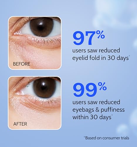 Image of Chemist at Play 30x Vitamin C Face Wash, 10% Vitamin C Face Serum & Under Eye Cream Combo | Fades Dark Spots, Brightens & Reduces Dark Circles & Puffiness | 100ml + 30ml + 15g