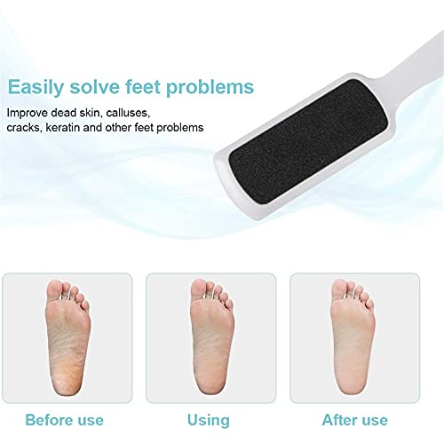 Stocking Stuffer For Men, Stocking Stuffers For Women Yeipis Pedicure Foot Rasp File Callus Remover, Double-Sided Colossal Foot Rasp Foot File And Callus Remover For Dead Skin (Pack Of 3) #TOP4