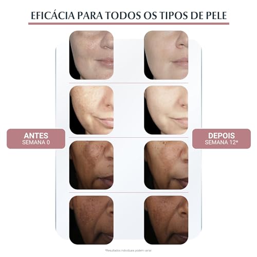 Creme Facial Dia Eucerin Anti-Pigment Dia FPS 30 50ml