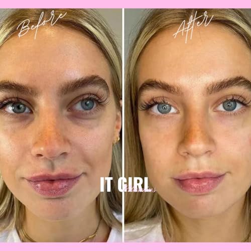 Skin Gummies for Women - Beauty Vitamin Gummy with Multi Collagen Peptides, Hyaluronic Acid, Retinol, Vegan Colostrum, Sea Moss & Antioxidants for Hydrated Clear Youthful Glowing Acne Prone Skincare - Image 5