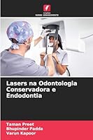 Lasers na Odontologia Conservadora e Endodontia (Portuguese Edition) 6208955696 Book Cover