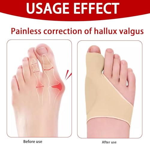 Eddrfy 2 PCS Hallux Valgus Korrektur Bandage, Unsichtbare Hallux Valgus Socken aus Elastischem Lycra & TPE, Wiederverwendbare Hallux Socken für Schmerzreduktion & Zehenkorrektur bei Tag & Nacht