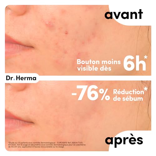 Dr. Herma - Patch Anti Bouton - Format XL - Résultats en 6 à 8h - Testé sous contrôle dermatologique - Acide Salicylique, Hydrocolloïdes, Huile d'Arbre à Thé - Boîte de 10 patchs – vue 4