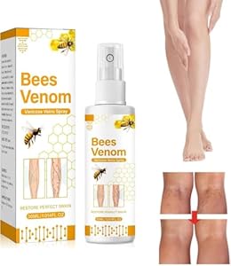 Ashopfun Bienengift Krampfadern Behandlungsspray (1 Stk.)