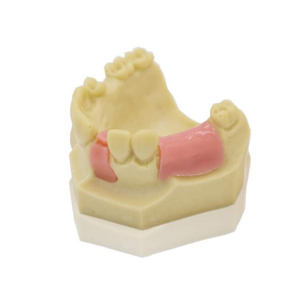 Zęby Model Denture Repair Sadzenie Szkolenia Żywicy Materiał Medyczny Pomoc Szkoleniowa Medyczna