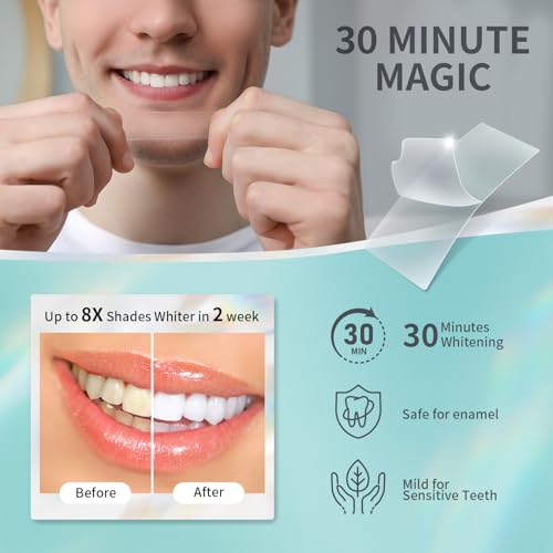 Carefor Teeth Whitening Strips 14 Treatments Kit - Contain Teeth Whitening Pen,Sensitive Teeth Whitener, Peroxide Free thumb #3