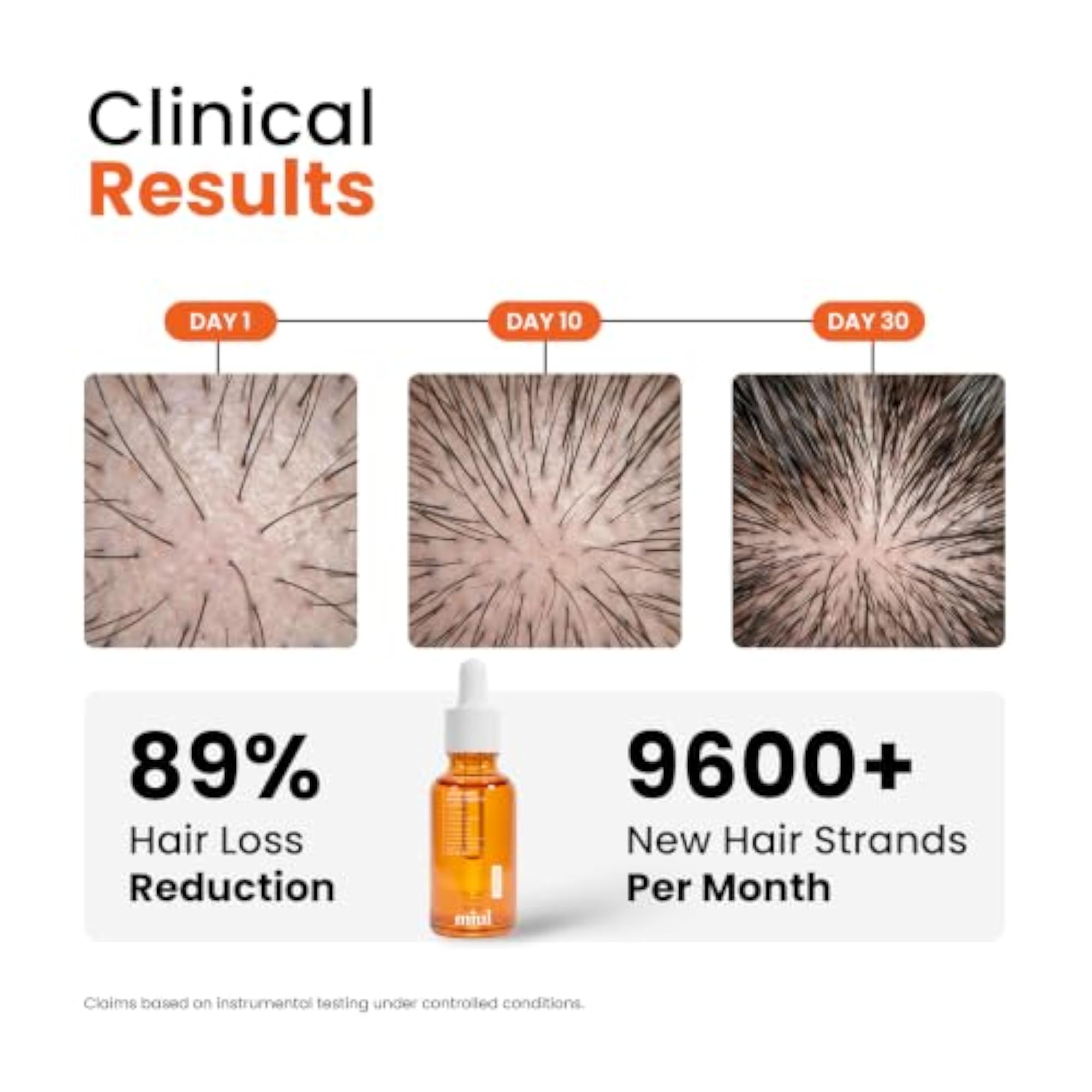 Advanced Hair Growth Serum with Anagain and Redensyl